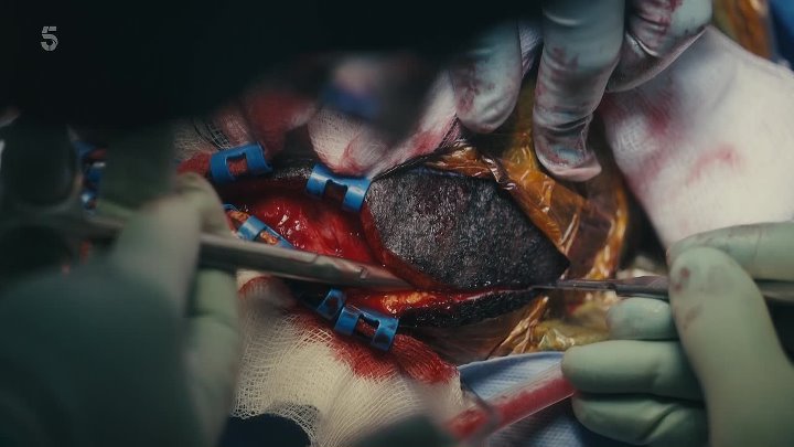⁣The Surgeon S01E03 1080p HDTV H264-DARKFLiX