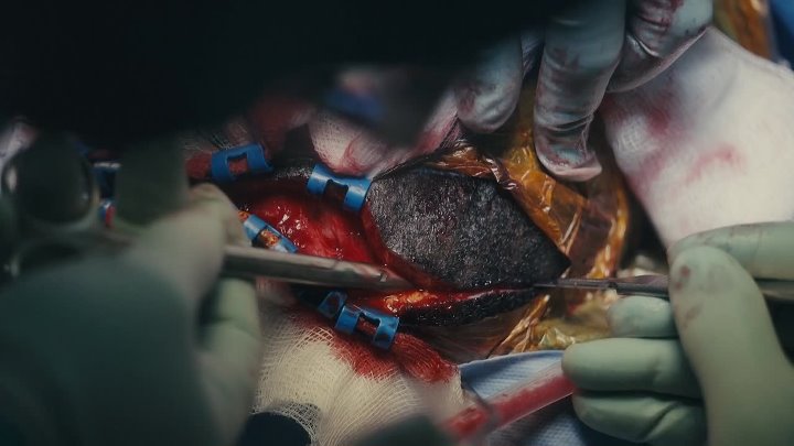 ⁣The Surgeon 2026 S01E03 1080p WEB H264-CBFM