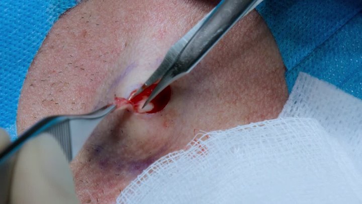 ⁣The Bad Skin Clinic S08E08 To Get a Diagnosis 1080p AMZN WEB-DL DDP2 0 H 264-RAWR