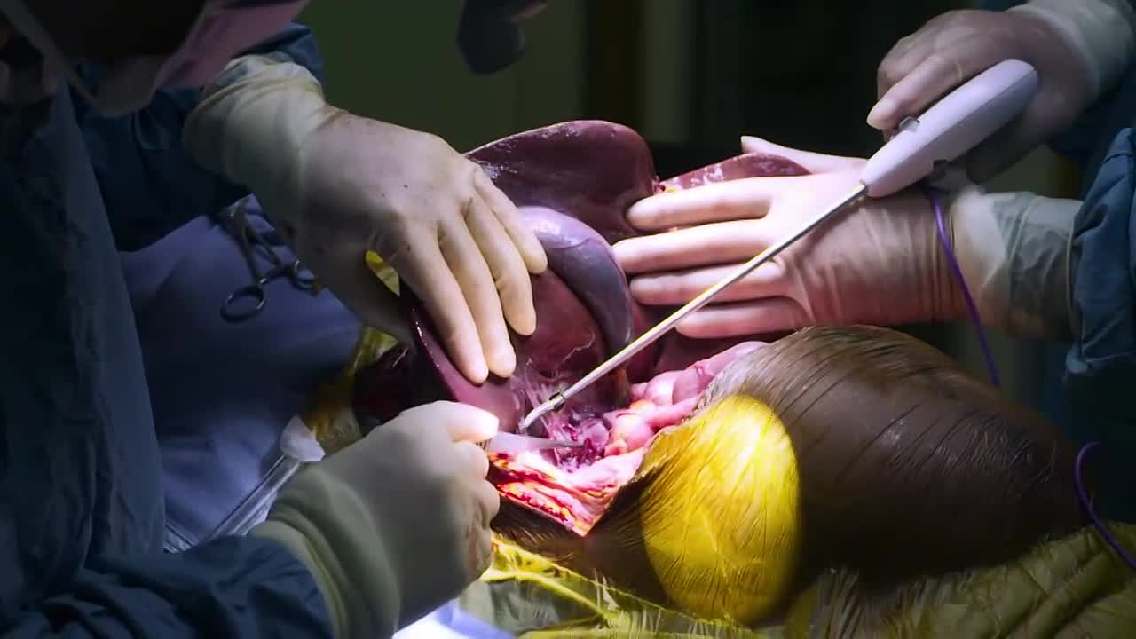 Surgeons A Matter of Life or Death S03E03 1080p MY5 WEB-DL AAC2 0 H 264-RAWR