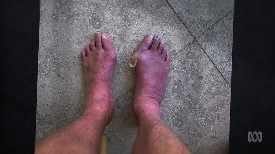 Australian Story S31E01 -Sink or Swim, Michael Klim