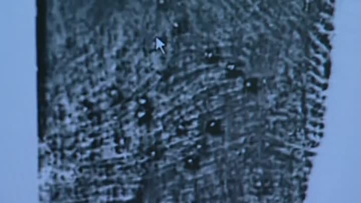 Medical Detectives Forensic Files  Season 12 Ep 22 Brotherly Love