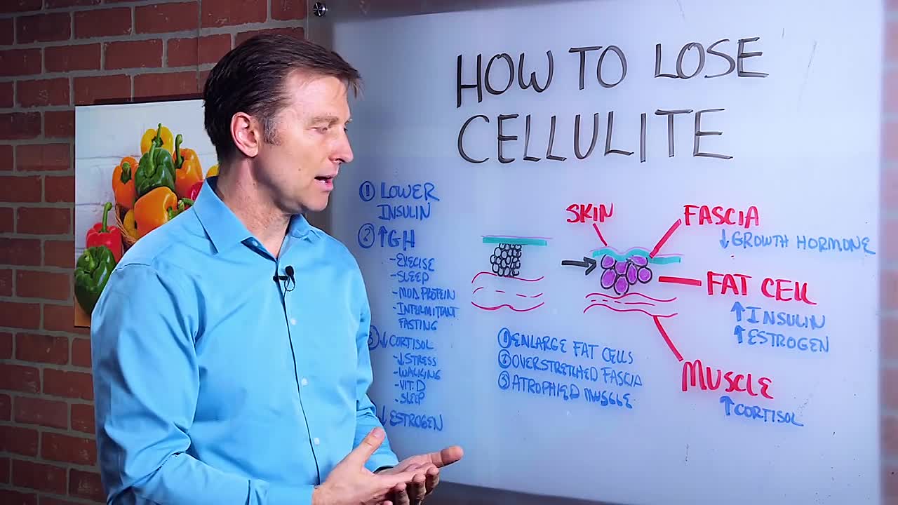 Cellulite Be Gone_ Dr. Berg's Expert Tips on Losing Thigh and Buttock Cellulite