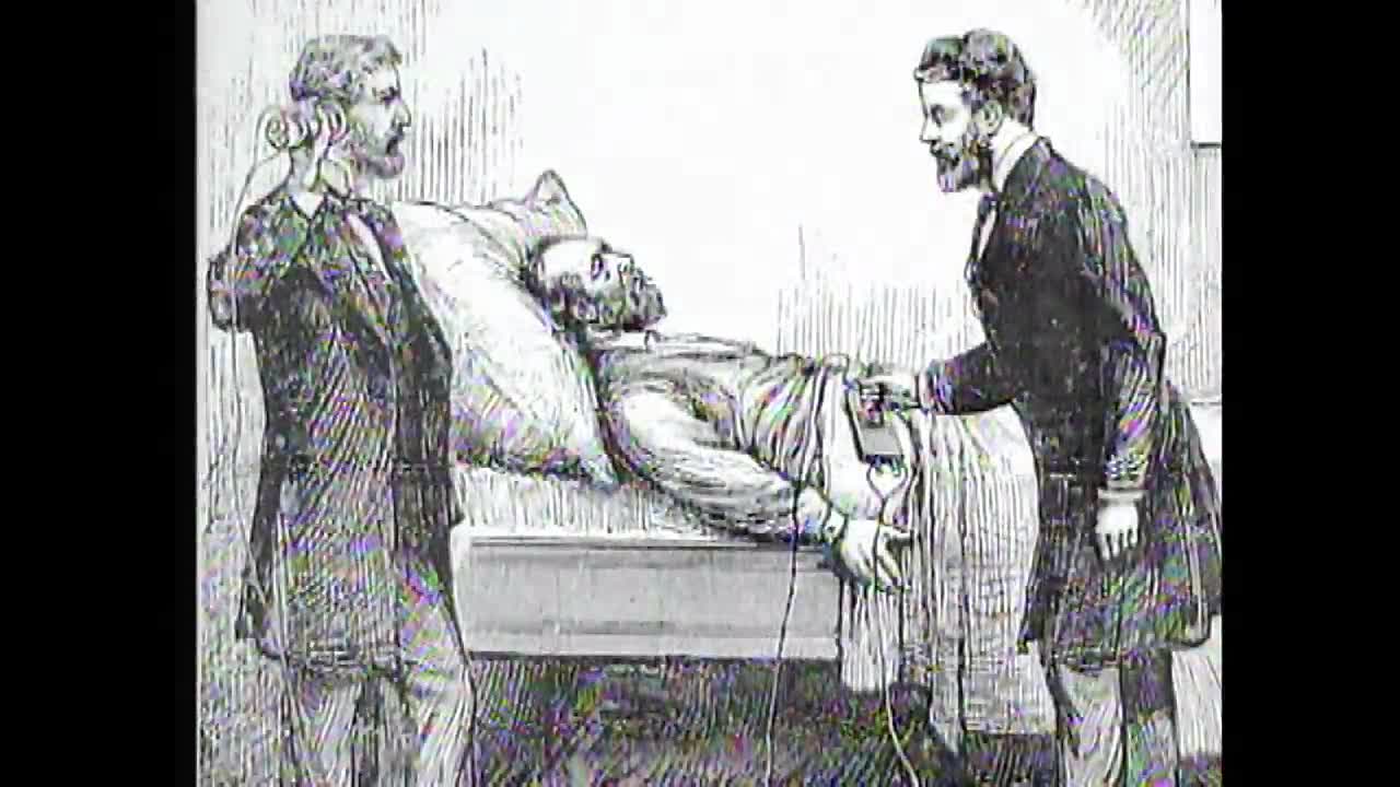 ⁣Alexander Graham Bell's Revolutionary Invention