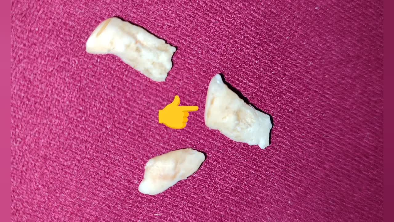 Was sind Wolfszähne¿ (1080p_30fps_H264-128kbit_AAC)