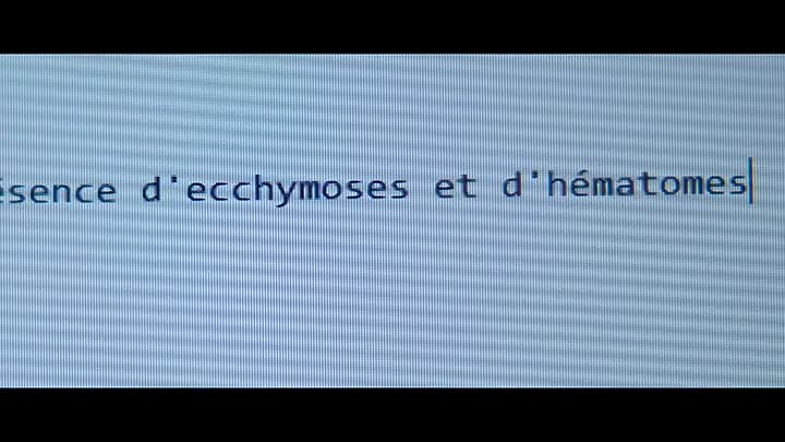 From Rock Star To Killer S01E03